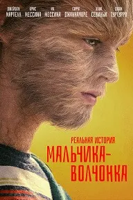 Реальная история мальчика-волчонка